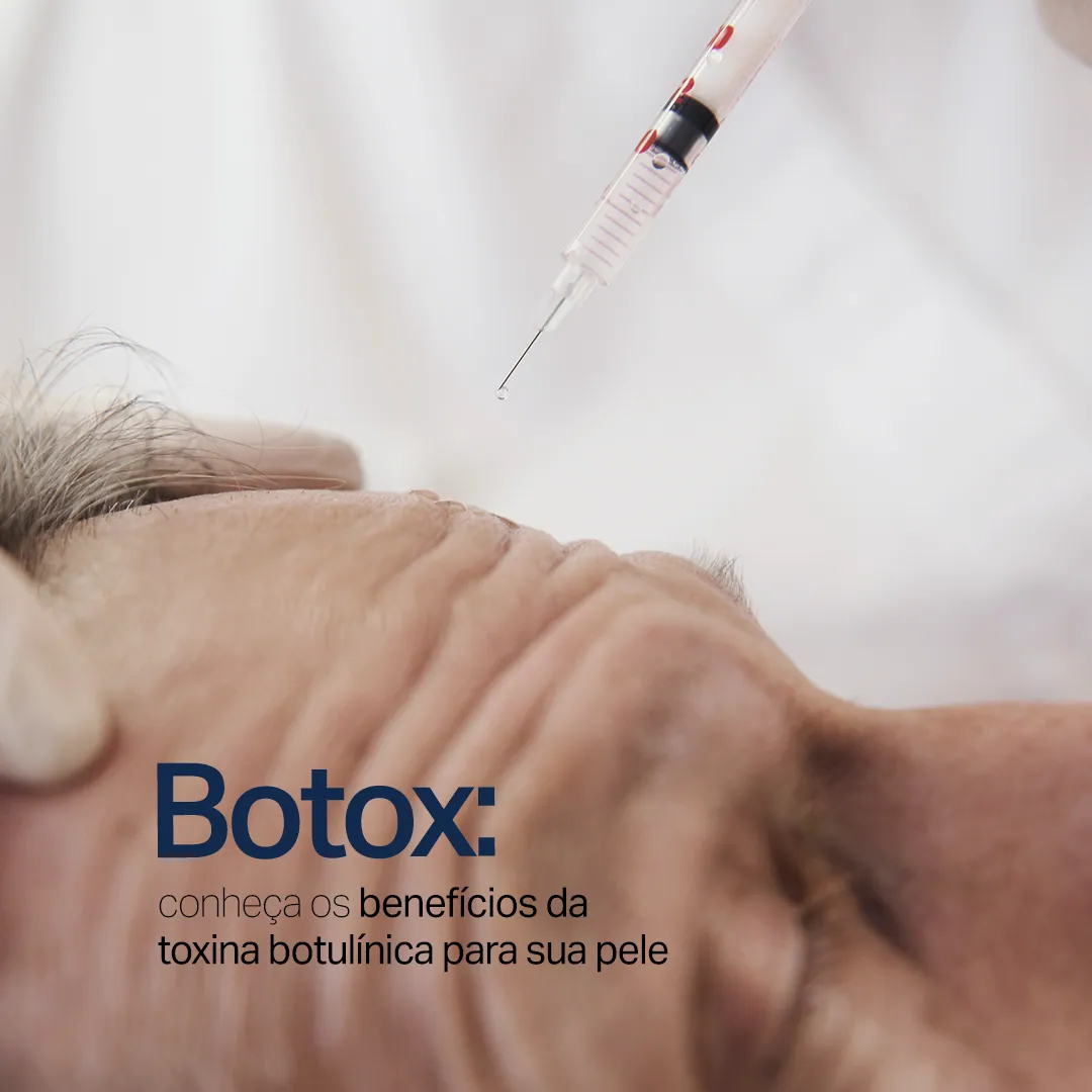 Sumaya Máttar Dermatologista - Juiz de Fora, MG - Tratamento Botox