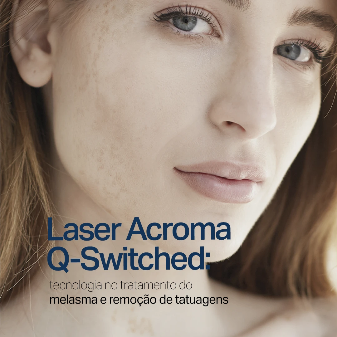Sumaya Máttar Dermatologista - Juiz de Fora, MG - Tratamento Laser Acroma Q-Switched