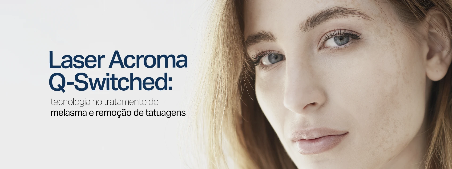 Sumaya Máttar Dermatologista - Juiz de Fora, MG - Tratamento Laser Acroma Q-Switched