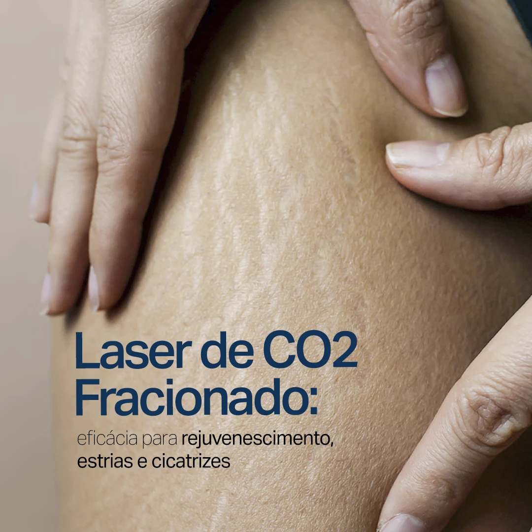 Sumaya Máttar Dermatologista - Juiz de Fora, MG - Tratamento Laser CO2 Fracionado